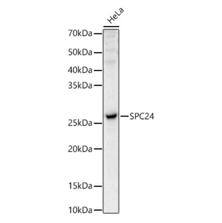 Western Blot - Anti-SPC24 Antibody (A88773) - Antibodies.com