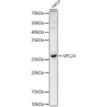 Western Blot - Anti-SPC24 Antibody (A88773) - Antibodies.com