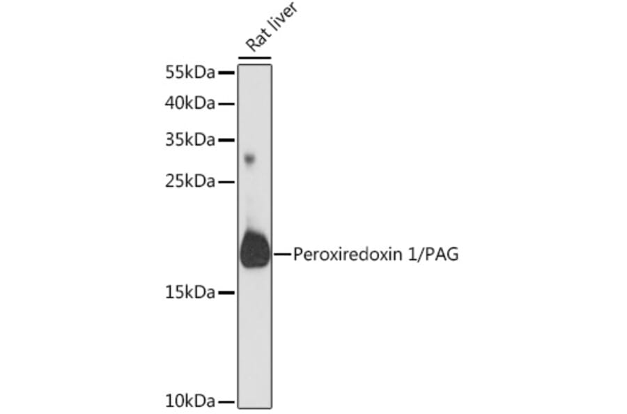 Western Blot - Anti-Peroxiredoxin 1 / PAG Antibody (A88774) - Antibodies.com