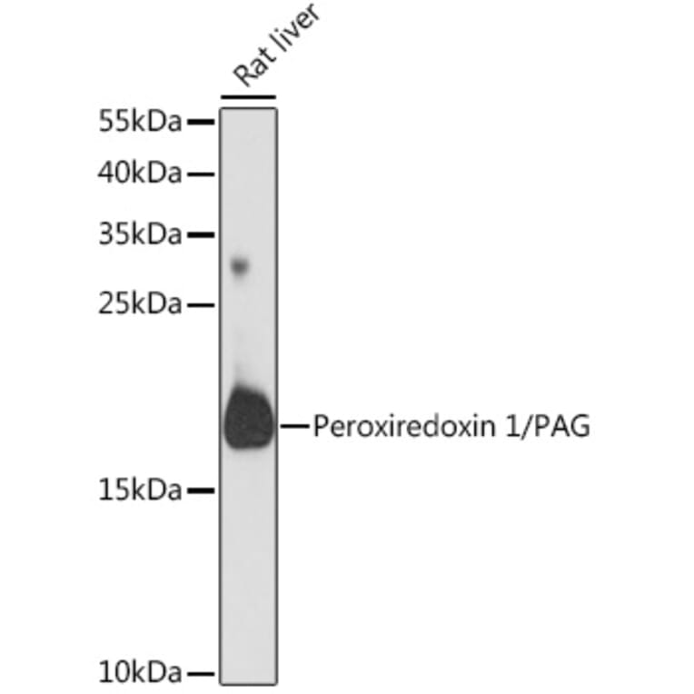 Western Blot - Anti-Peroxiredoxin 1 / PAG Antibody (A88774) - Antibodies.com
