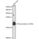 Western Blot - Anti-Peroxiredoxin 1 / PAG Antibody (A88774) - Antibodies.com