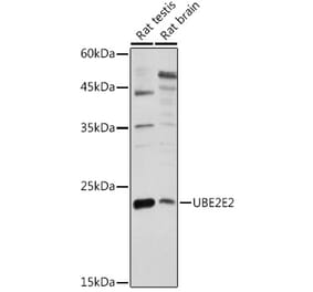 Western Blot - Anti-UBE2E2 Antibody (A88775) - Antibodies.com