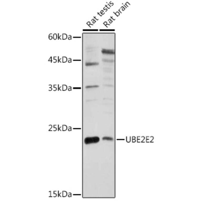 Western Blot - Anti-UBE2E2 Antibody (A88775) - Antibodies.com