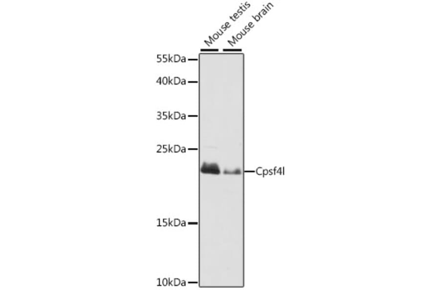 Western Blot - Anti-CPSF4L Antibody (A88776) - Antibodies.com