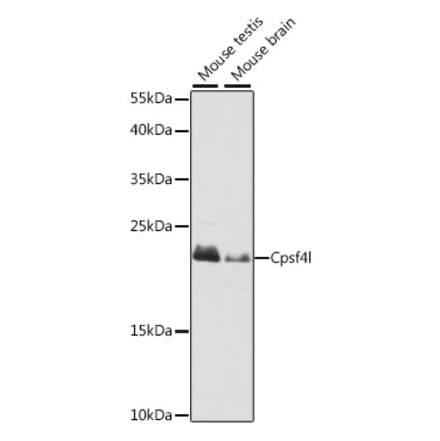 Western Blot - Anti-CPSF4L Antibody (A88776) - Antibodies.com