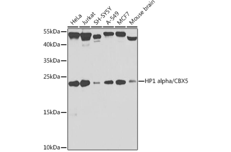Western Blot - Anti-HP1 alpha Antibody (A88778) - Antibodies.com