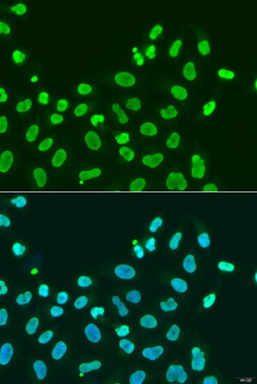 Anti-HP1 alpha Antibody (A88778) | Antibodies.com