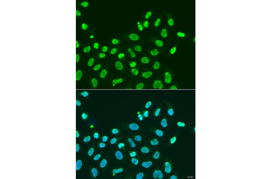 Immunofluorescence - Anti-HP1 alpha Antibody (A88778) - Antibodies.com