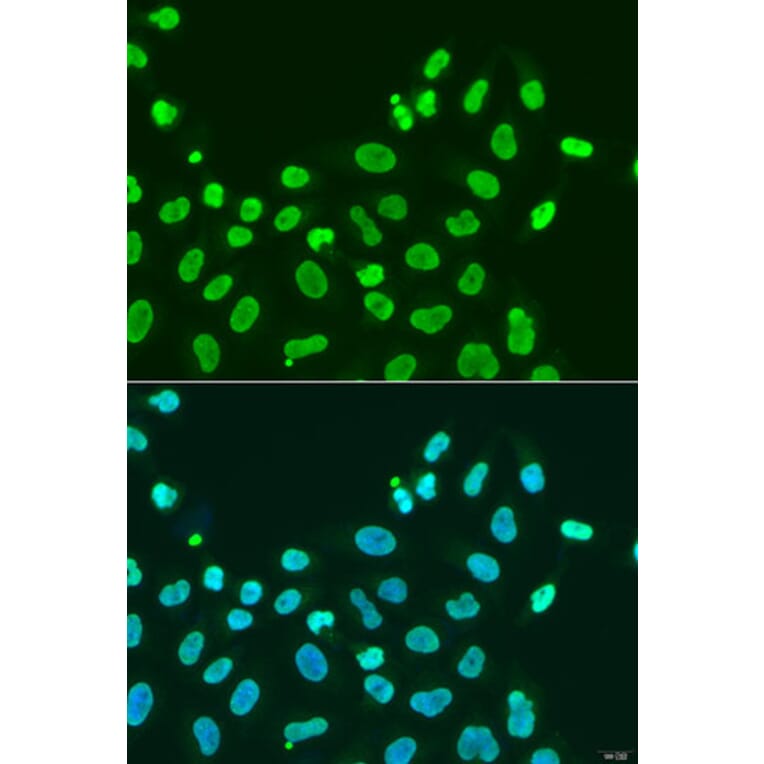 Immunofluorescence - Anti-HP1 alpha Antibody (A88778) - Antibodies.com