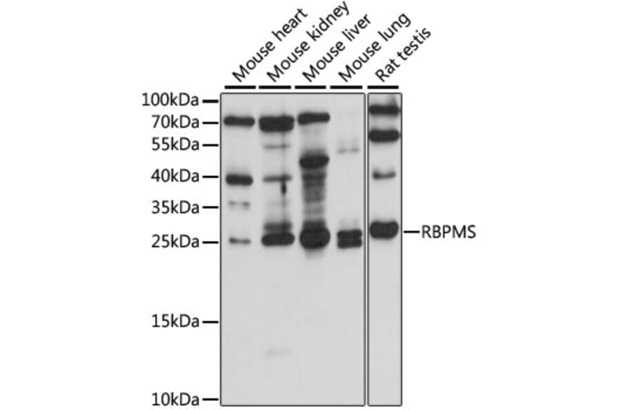 Western Blot - Anti-RBPMS Antibody (A88779) - Antibodies.com