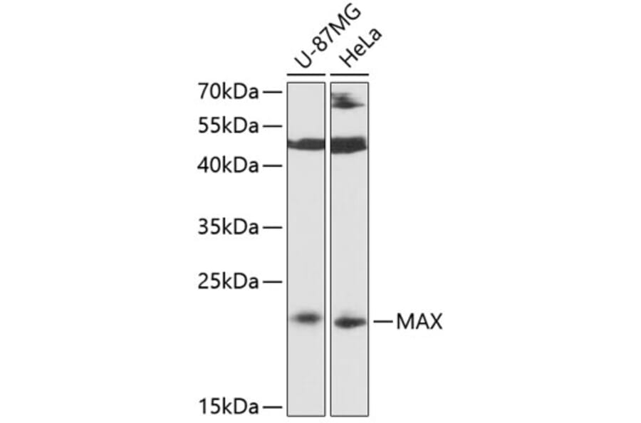 Western Blot - Anti-MAX Antibody (A88780) - Antibodies.com