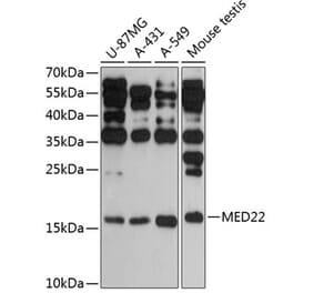 Western Blot - Anti-MED22 Antibody (A88781) - Antibodies.com