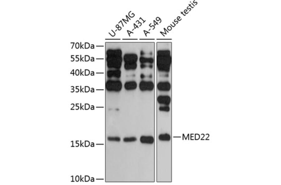 Western Blot - Anti-MED22 Antibody (A88781) - Antibodies.com