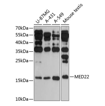 Western Blot - Anti-MED22 Antibody (A88781) - Antibodies.com