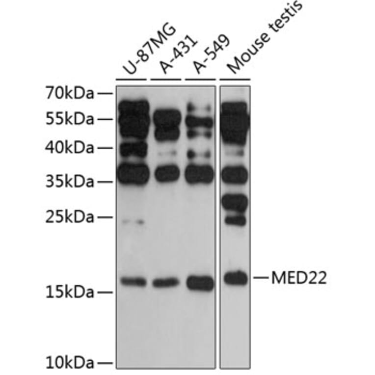 Western Blot - Anti-MED22 Antibody (A88781) - Antibodies.com