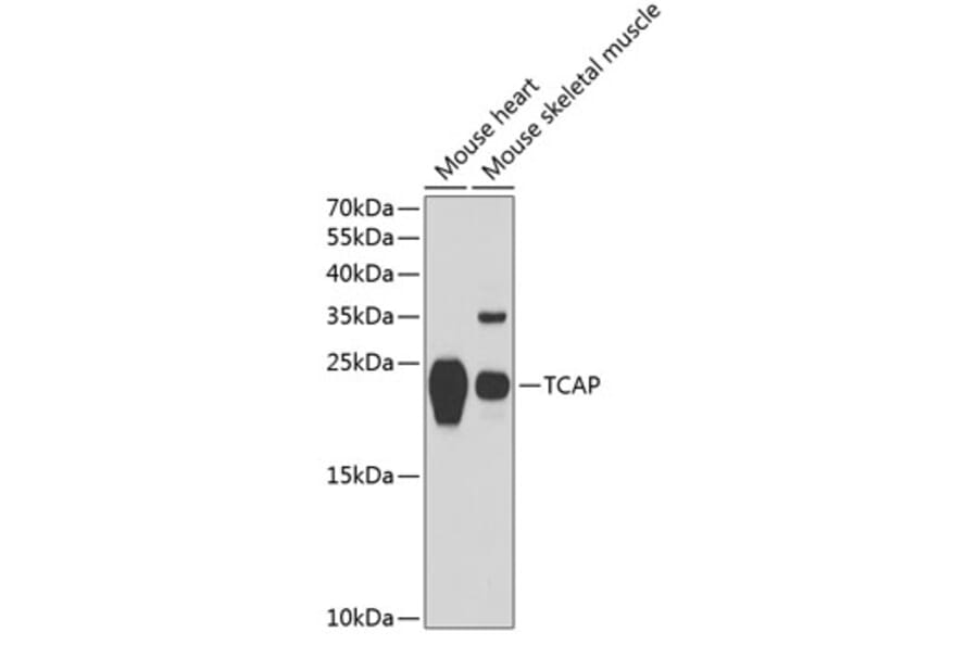 Western Blot - Anti-Telethonin Antibody (A88782) - Antibodies.com