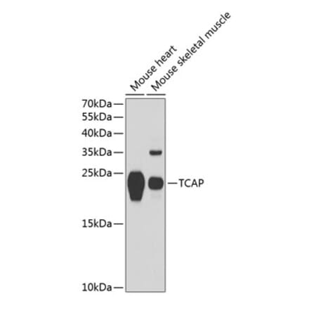 Western Blot - Anti-Telethonin Antibody (A88782) - Antibodies.com