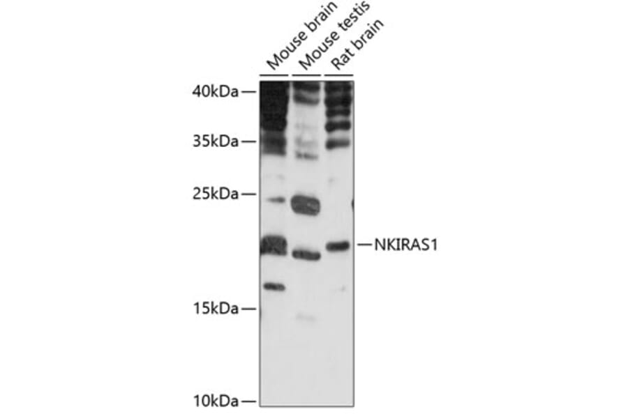 Western Blot - Anti-NKIRAS1 Antibody (A88783) - Antibodies.com