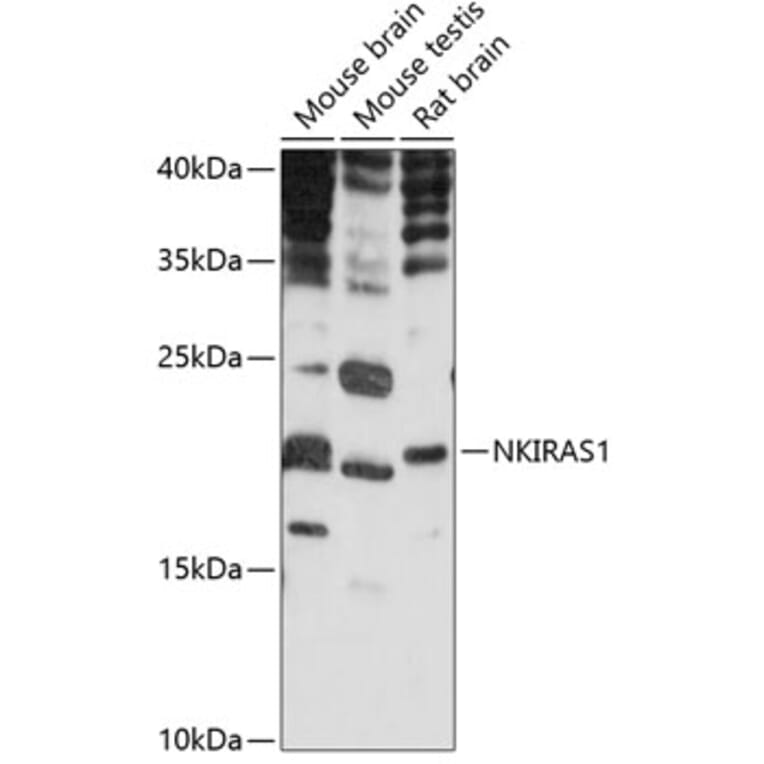 Western Blot - Anti-NKIRAS1 Antibody (A88783) - Antibodies.com