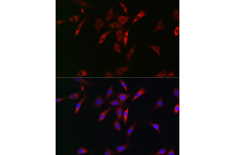Immunofluorescence - Anti-NKIRAS1 Antibody (A88783) - Antibodies.com