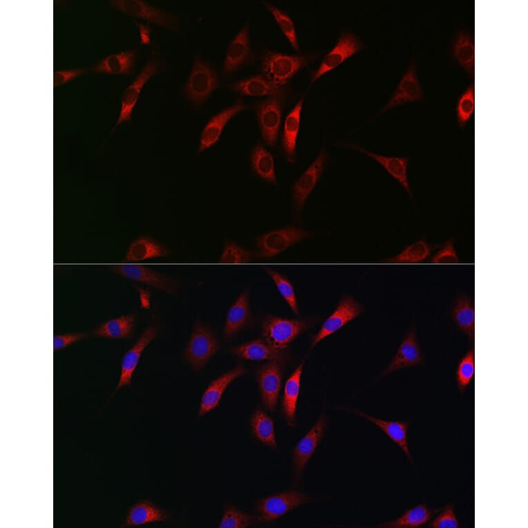 Immunofluorescence - Anti-NKIRAS1 Antibody (A88783) - Antibodies.com