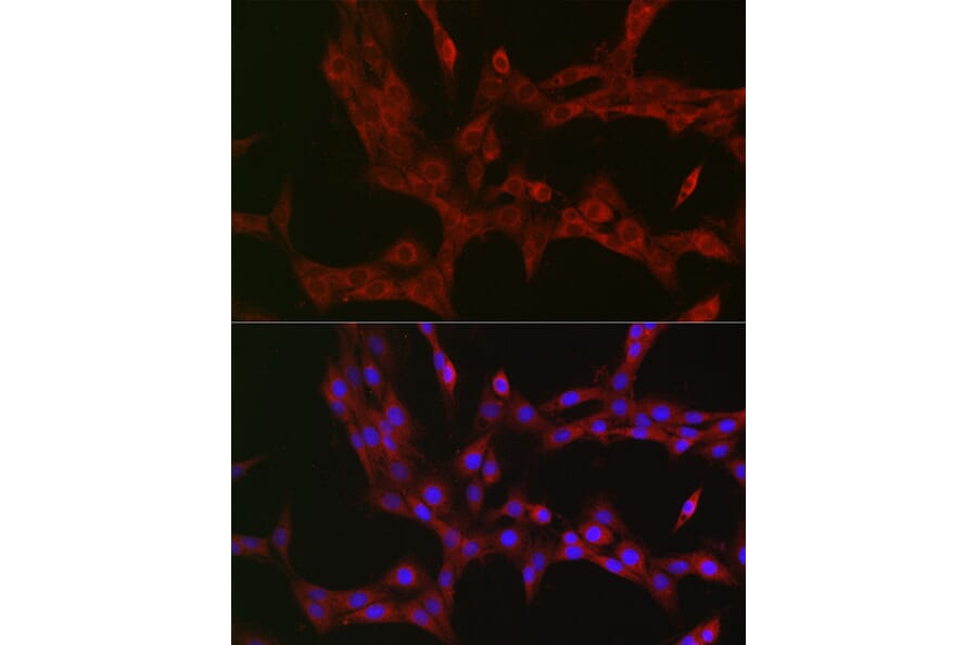 Immunofluorescence - Anti-NKIRAS1 Antibody (A88783) - Antibodies.com