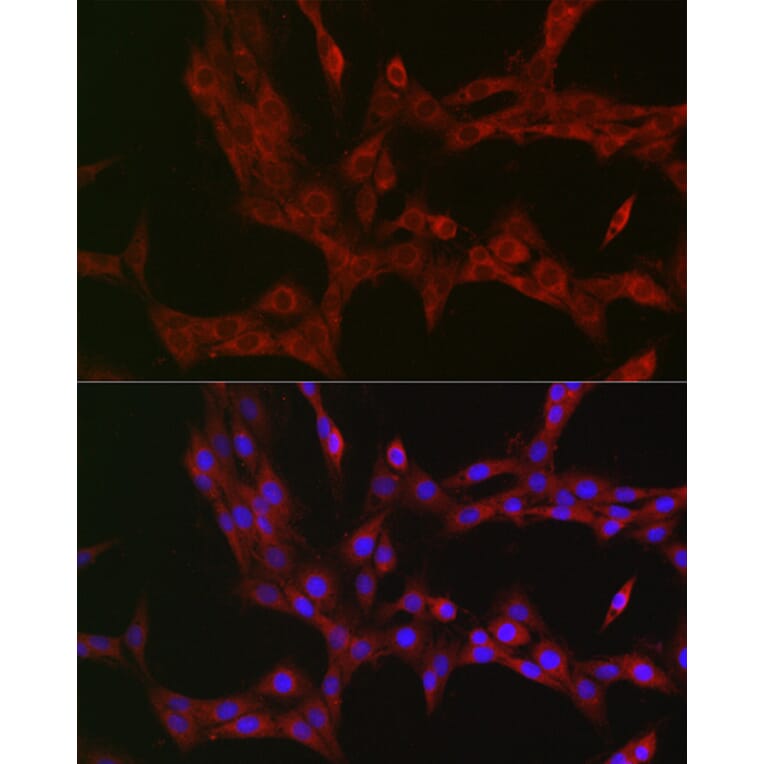 Immunofluorescence - Anti-NKIRAS1 Antibody (A88783) - Antibodies.com
