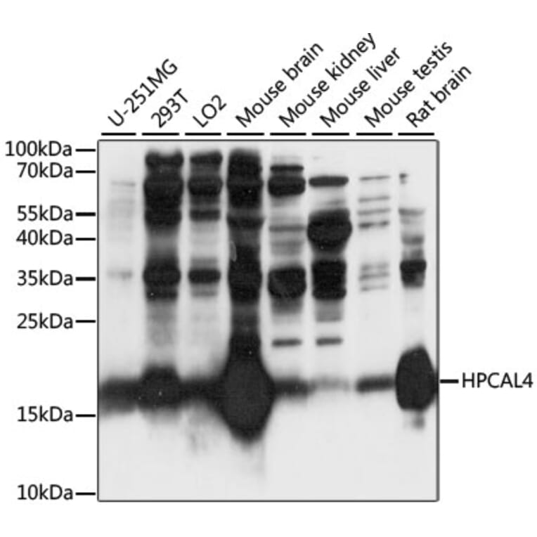 Western Blot - Anti-HPCAL4 Antibody (A88784) - Antibodies.com
