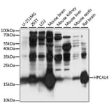 Western Blot - Anti-HPCAL4 Antibody (A88784) - Antibodies.com