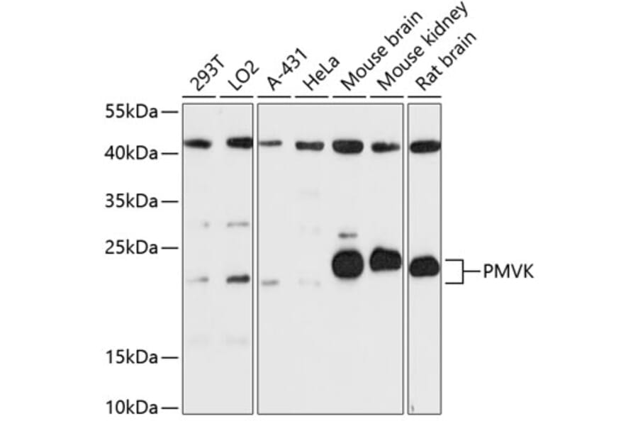 Western Blot - Anti-Phosphomevalonate kinase Antibody (A88785) - Antibodies.com