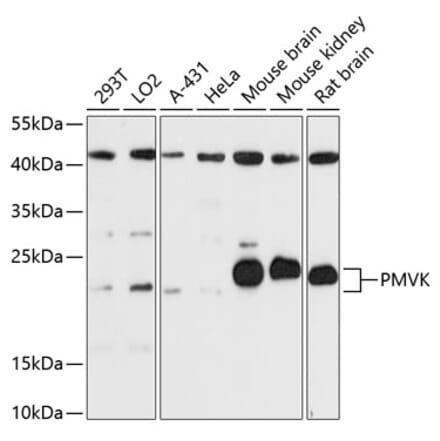 Western Blot - Anti-Phosphomevalonate kinase Antibody (A88785) - Antibodies.com