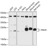 Western Blot - Anti-Phosphomevalonate kinase Antibody (A88785) - Antibodies.com