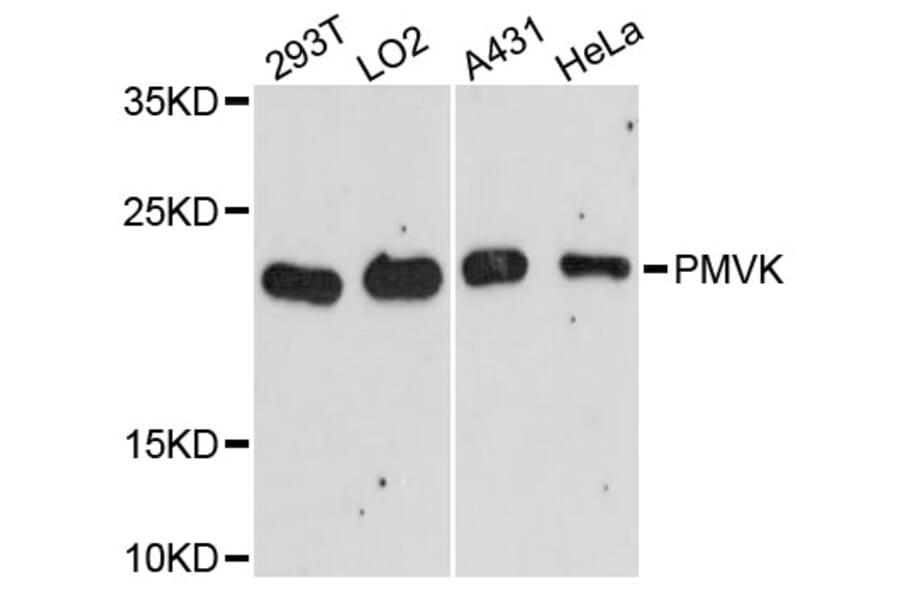 Western Blot - Anti-PMVK Antibody (A13866) - Antibodies.com