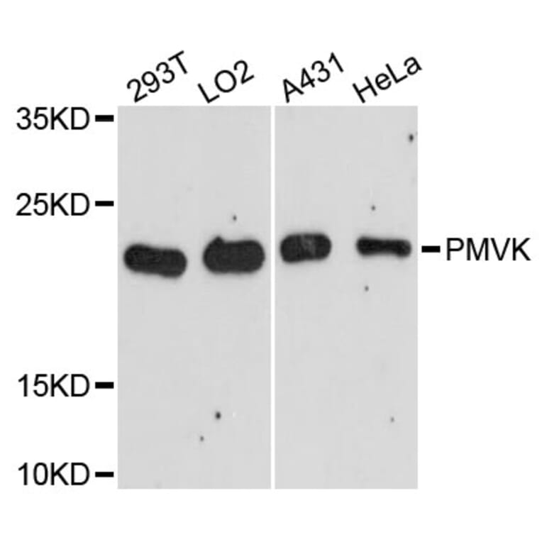 Western Blot - Anti-PMVK Antibody (A13866) - Antibodies.com
