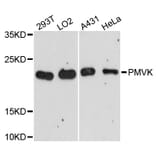 Western Blot - Anti-PMVK Antibody (A13866) - Antibodies.com
