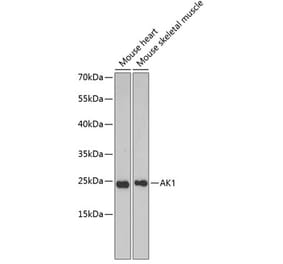 Western Blot - Anti-AK 1 Antibody (A88787) - Antibodies.com