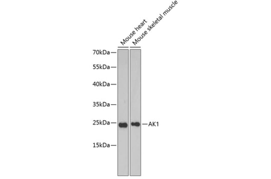 Western Blot - Anti-AK 1 Antibody (A88787) - Antibodies.com