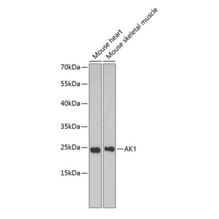 Western Blot - Anti-AK 1 Antibody (A88787) - Antibodies.com