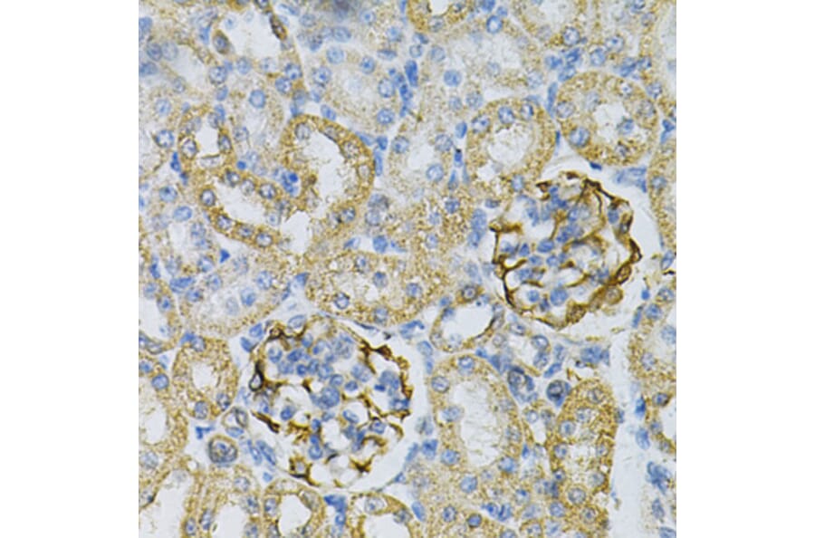 Immunohistochemistry - Anti-AK 1 Antibody (A88787) - Antibodies.com