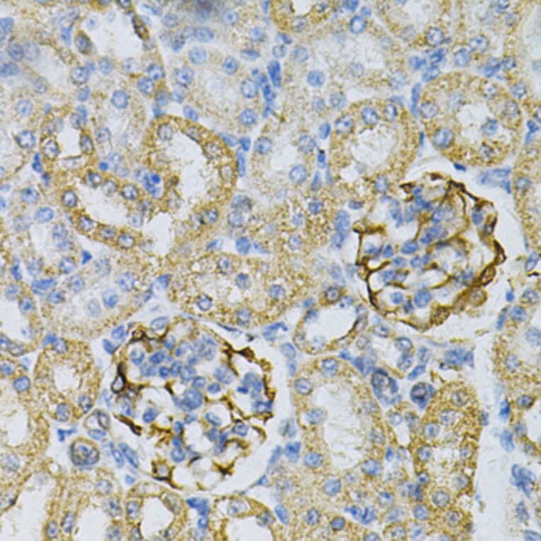 Immunohistochemistry - Anti-AK 1 Antibody (A88787) - Antibodies.com