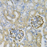 Immunohistochemistry - Anti-AK 1 Antibody (A88787) - Antibodies.com