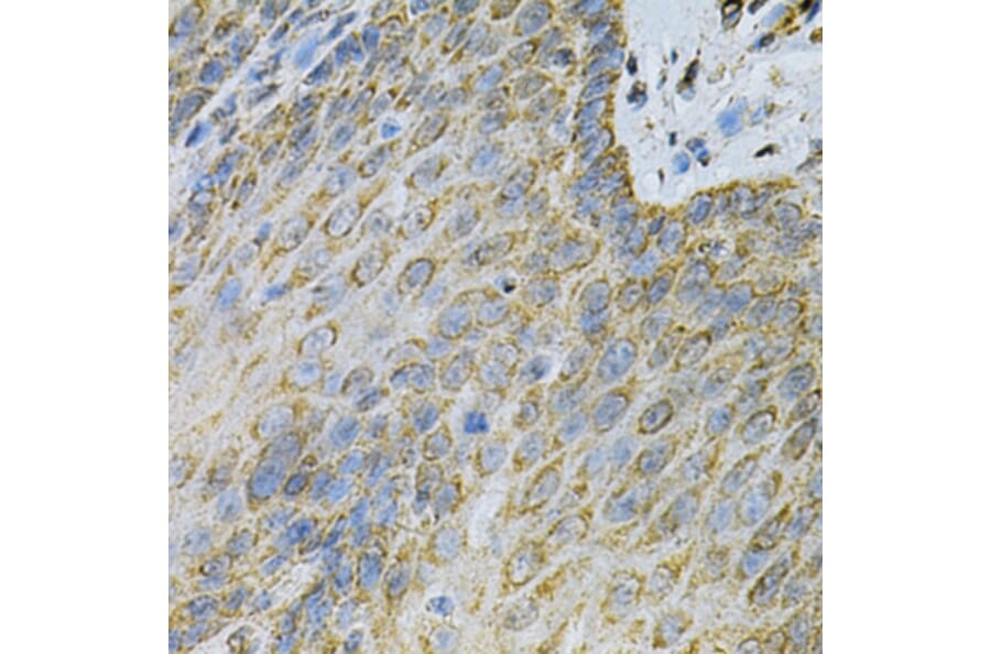 Immunohistochemistry - Anti-AK 1 Antibody (A88787) - Antibodies.com