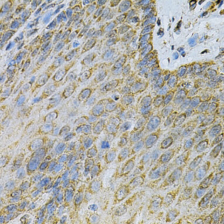 Immunohistochemistry - Anti-AK 1 Antibody (A88787) - Antibodies.com