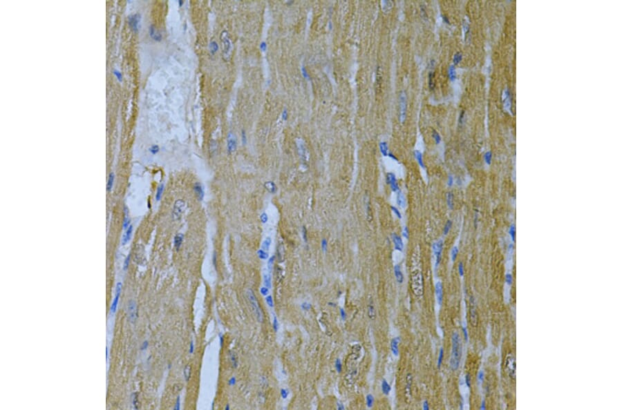 Immunohistochemistry - Anti-AK 1 Antibody (A88787) - Antibodies.com