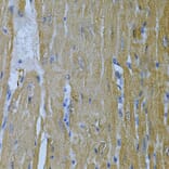Immunohistochemistry - Anti-AK 1 Antibody (A88787) - Antibodies.com