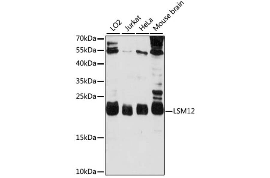Western Blot - Anti-LSM12 Antibody (A88788) - Antibodies.com