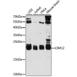 Western Blot - Anti-LSM12 Antibody (A88788) - Antibodies.com