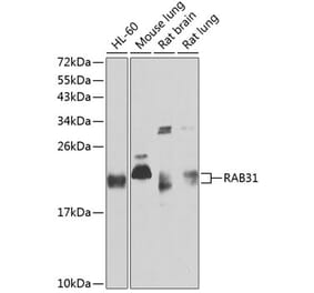 Western Blot - Anti-RAB31 Antibody (A88789) - Antibodies.com