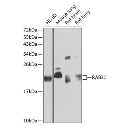 Western Blot - Anti-RAB31 Antibody (A88789) - Antibodies.com