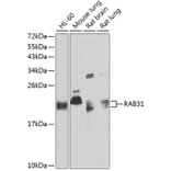 Western Blot - Anti-RAB31 Antibody (A88789) - Antibodies.com